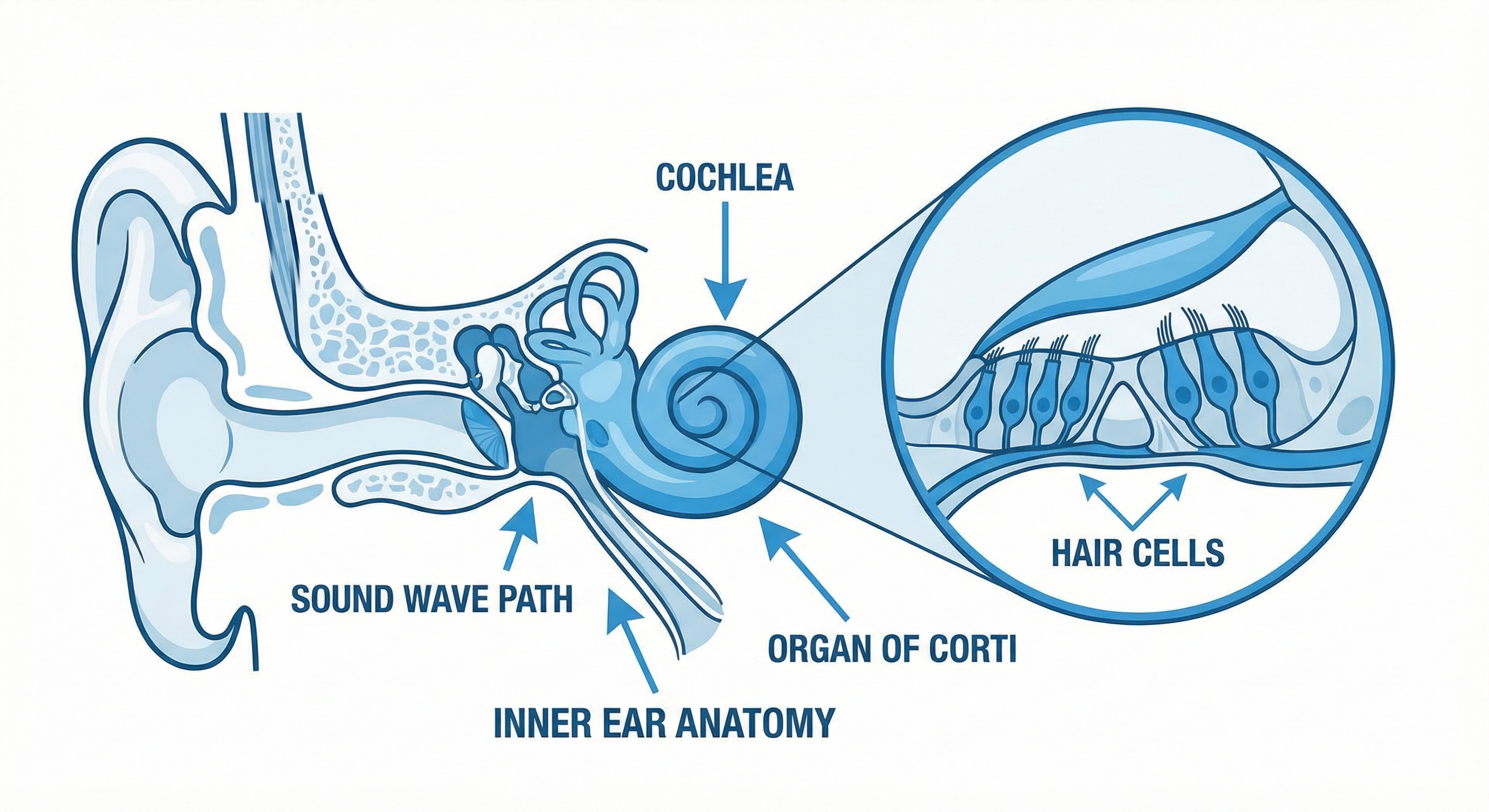 Menieres disease symptoms causes and management